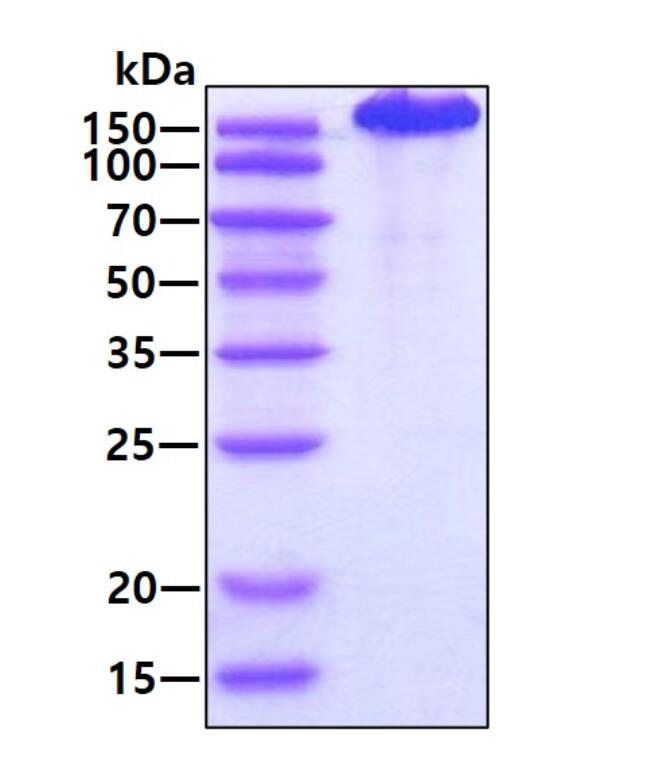 3 μg by SDS-PAGE under reducing condition and visualized by coomassie blue stain